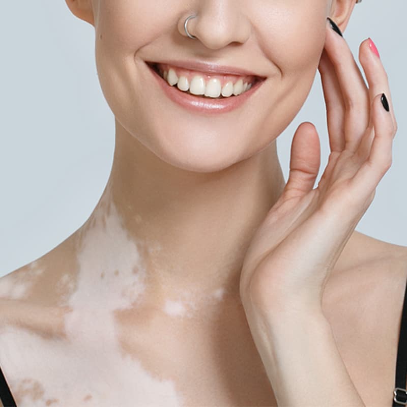 Benefit 3